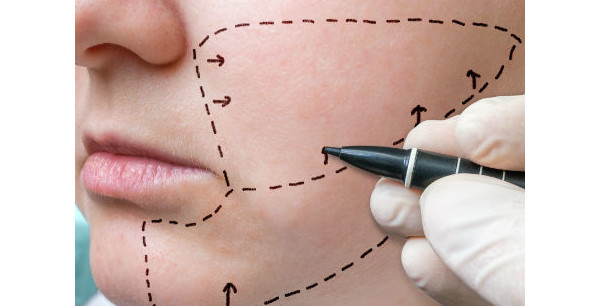 imagem de um dentista de luvas desenhando no rosto da paciente