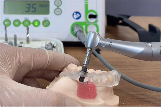Guia cirúrgico para implante guiado e teste.