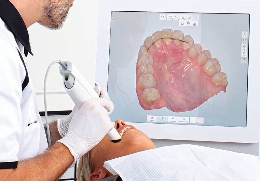 Dentista olhando por imagem intraoral na tela.