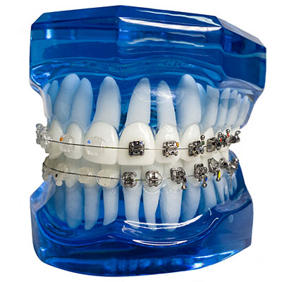 Manequim de ortodontia