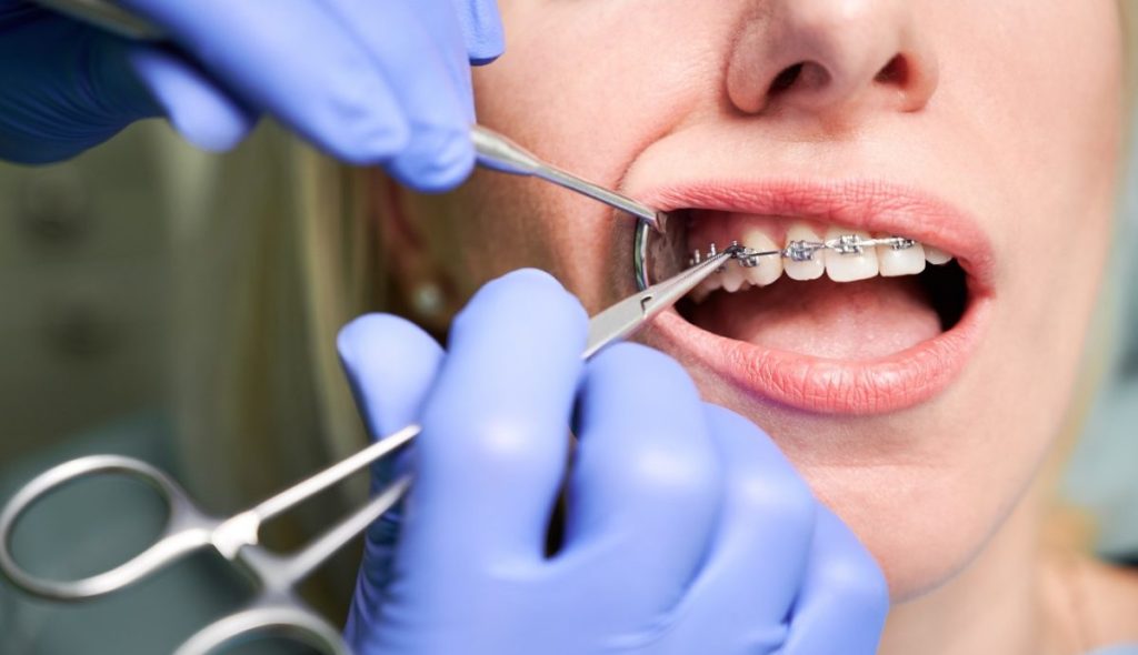 Dentista ajustando aparelho ortodôntico