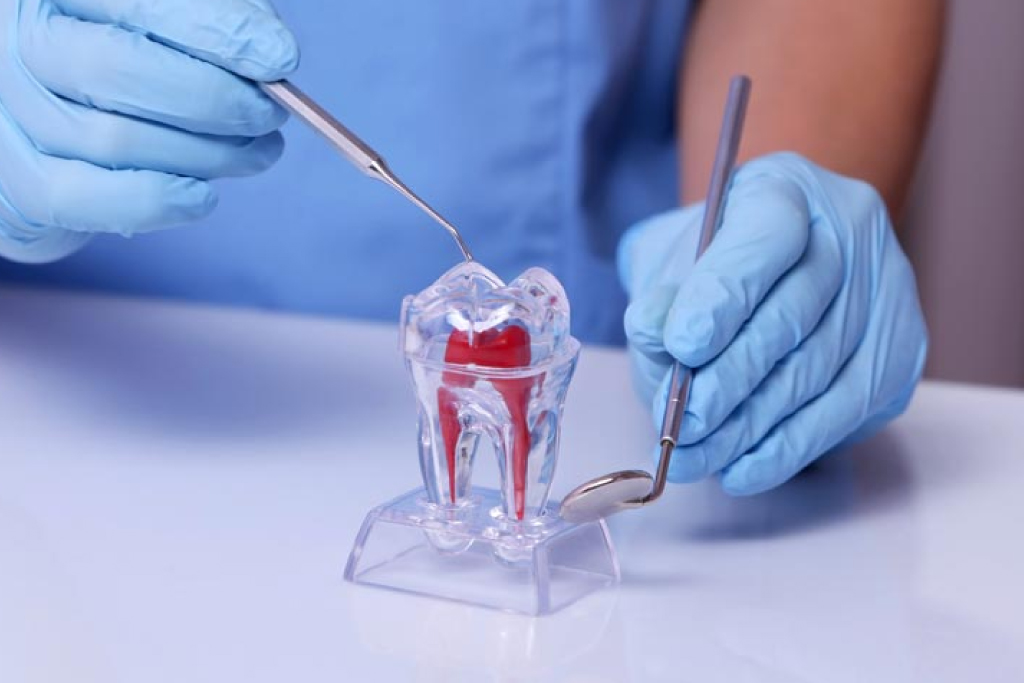 Dentista com seus instrumentos perto de molde de dente com canal grande em vidro