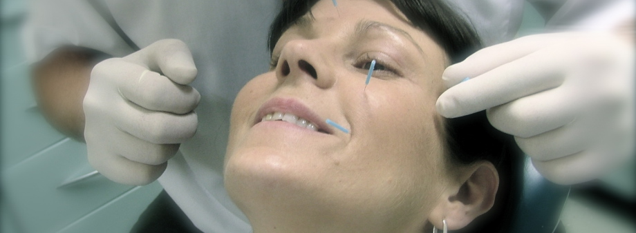 Acupuntura no rosto de paciente mulher.