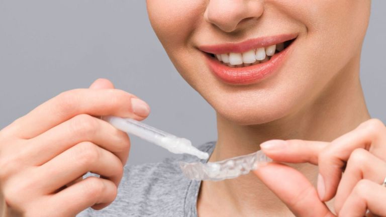 Clareamento Dental: Qual Escolher e Como Funciona?