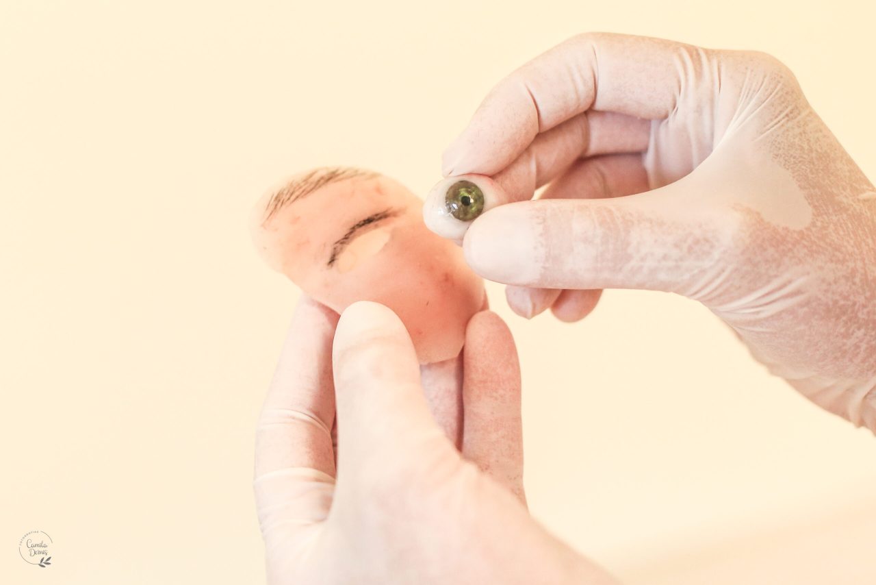 Segurando prótese de olho.