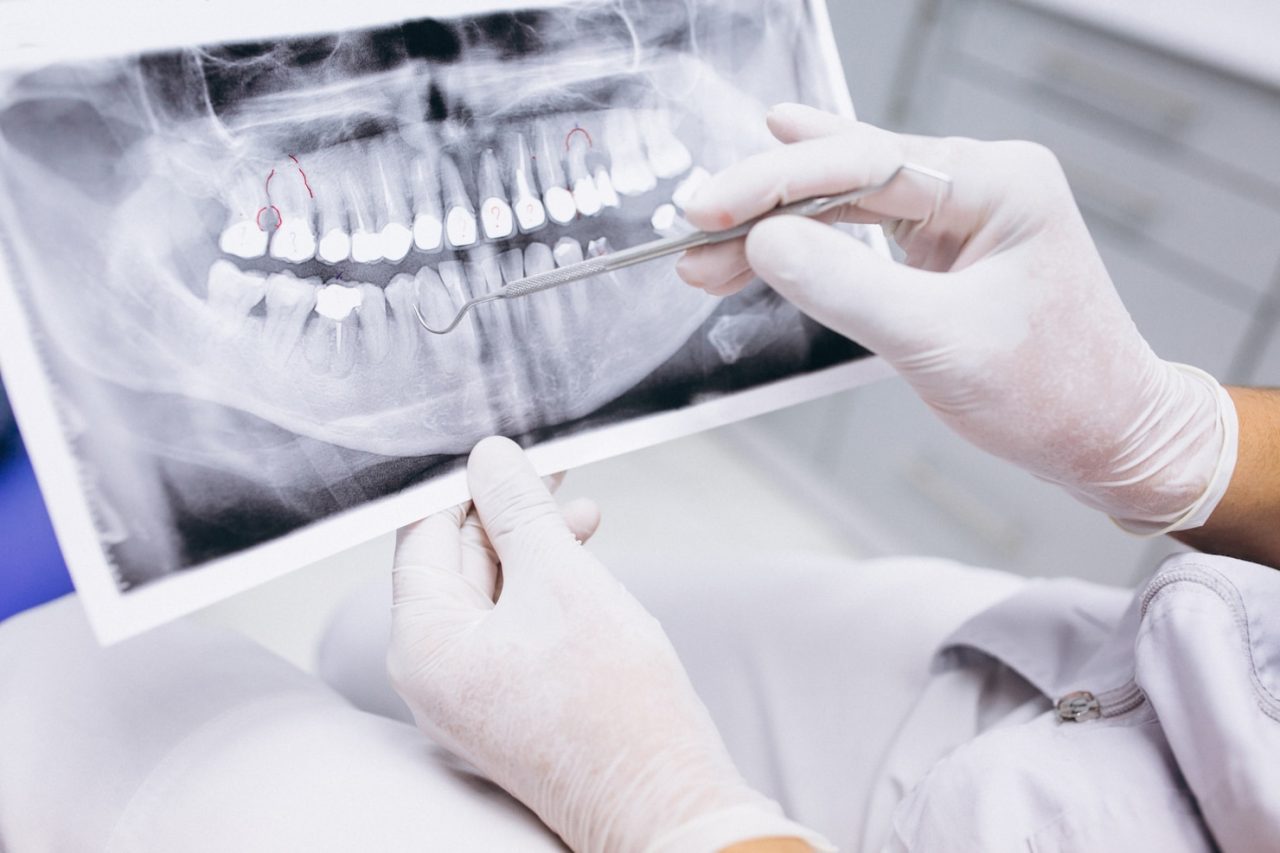 dentista com radiografia em mãos apontando para uma parte específica