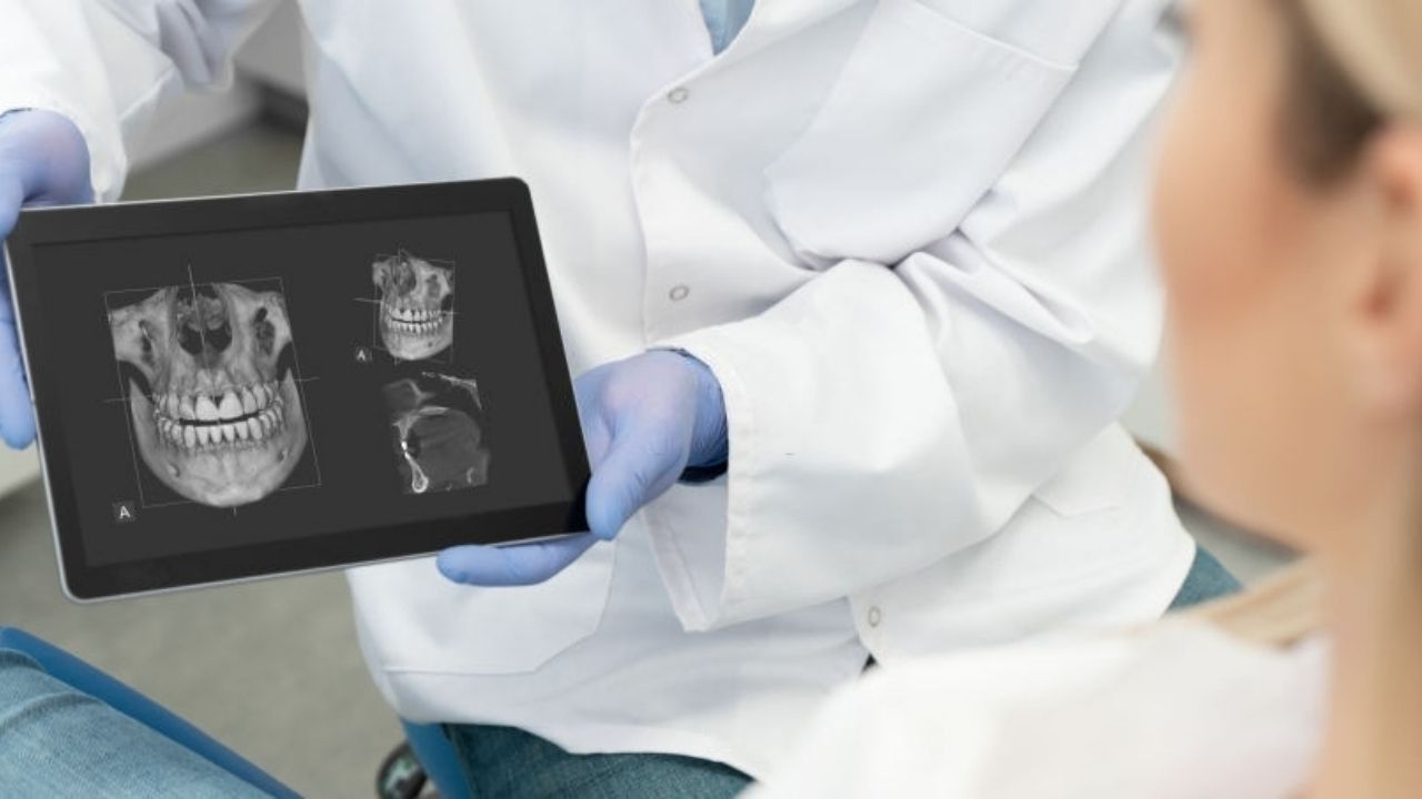 dentista mostrando tomografia para paciente