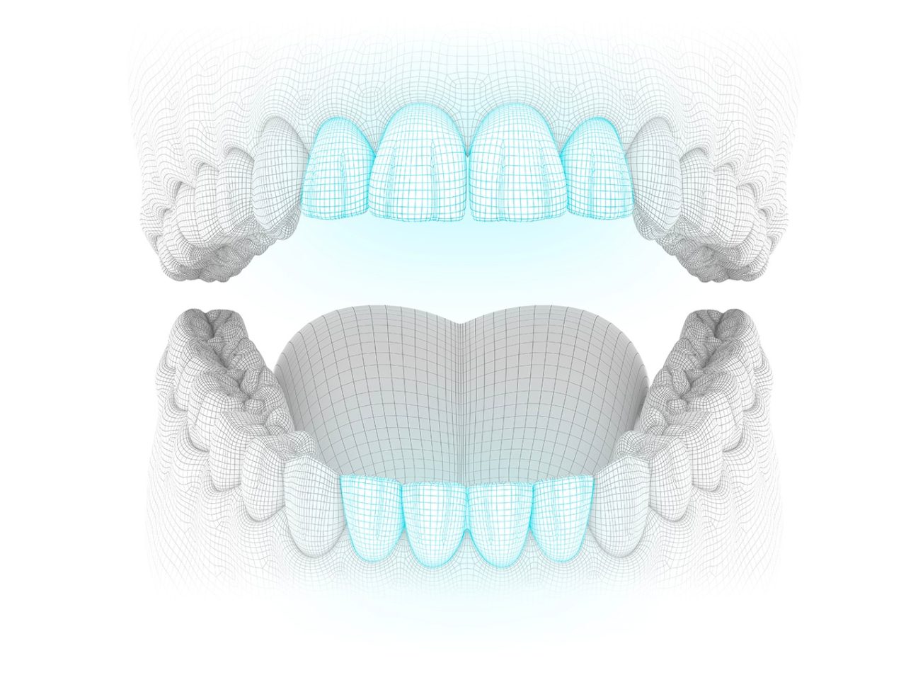 desenho 3d de arcada dentária com os dentes incisivos destacados