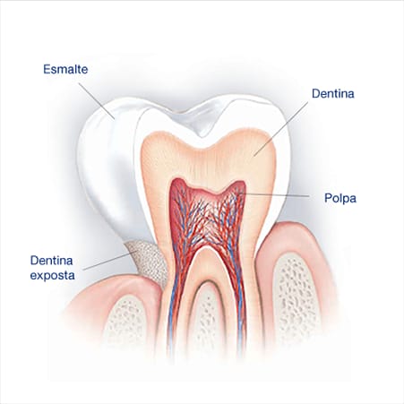 desenho mostrando as partes do dente