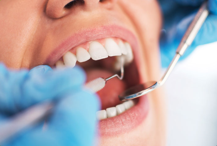 boca aberta e dentista analisando