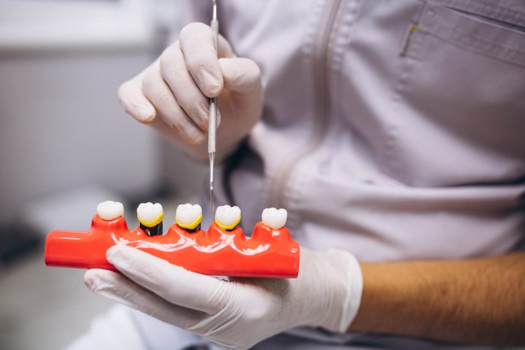 Dentista segurando molde de dentes para realizar uma explicação