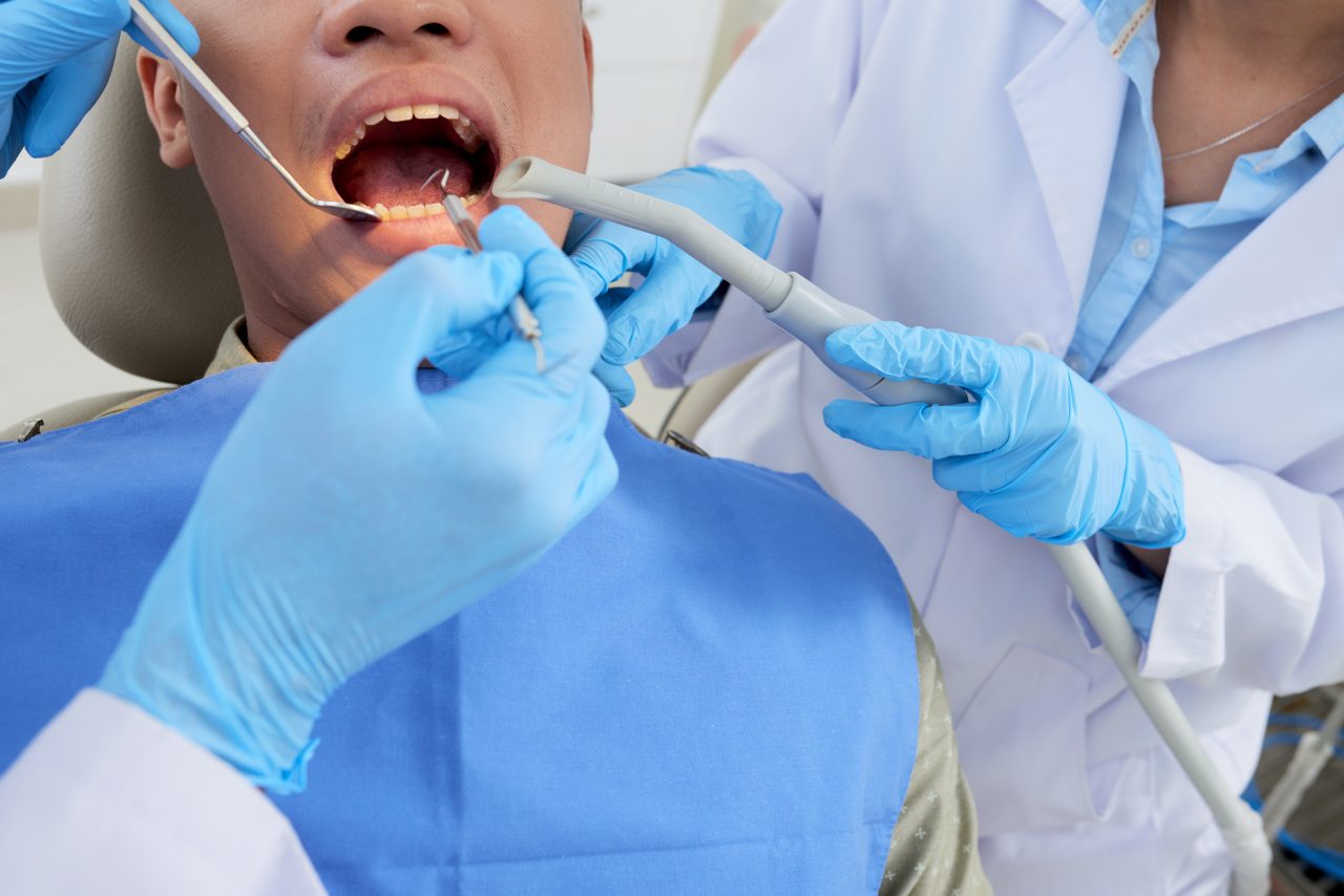 Dentistas fazendo limpeza em dente de paciente