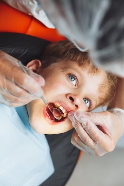 Criança no dentista passando por tratamento de cárie, o dentista está olhando a parte de trás dos dentes com um espelhinho
