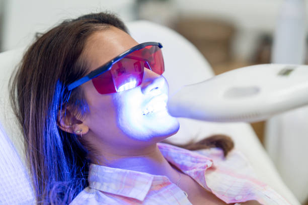 Paciente mulher usando óculos vermelho de proteção e passando por clareamento dental a laser