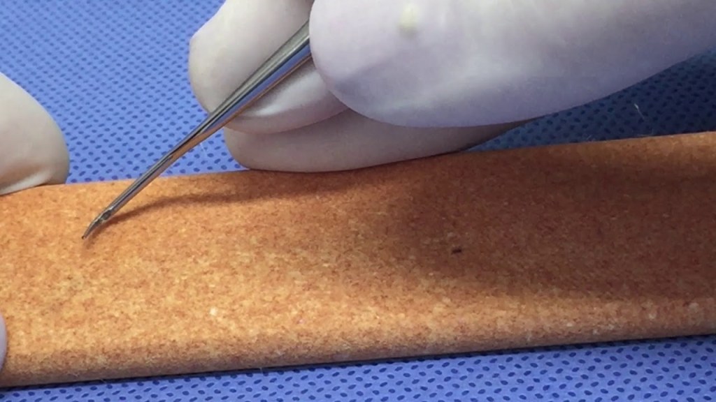 Dentista de luva afiando cureta odntológica