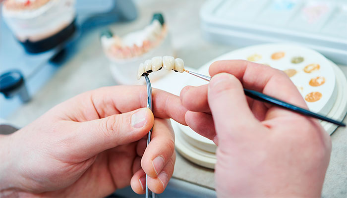Protético fabricando prótese dentária