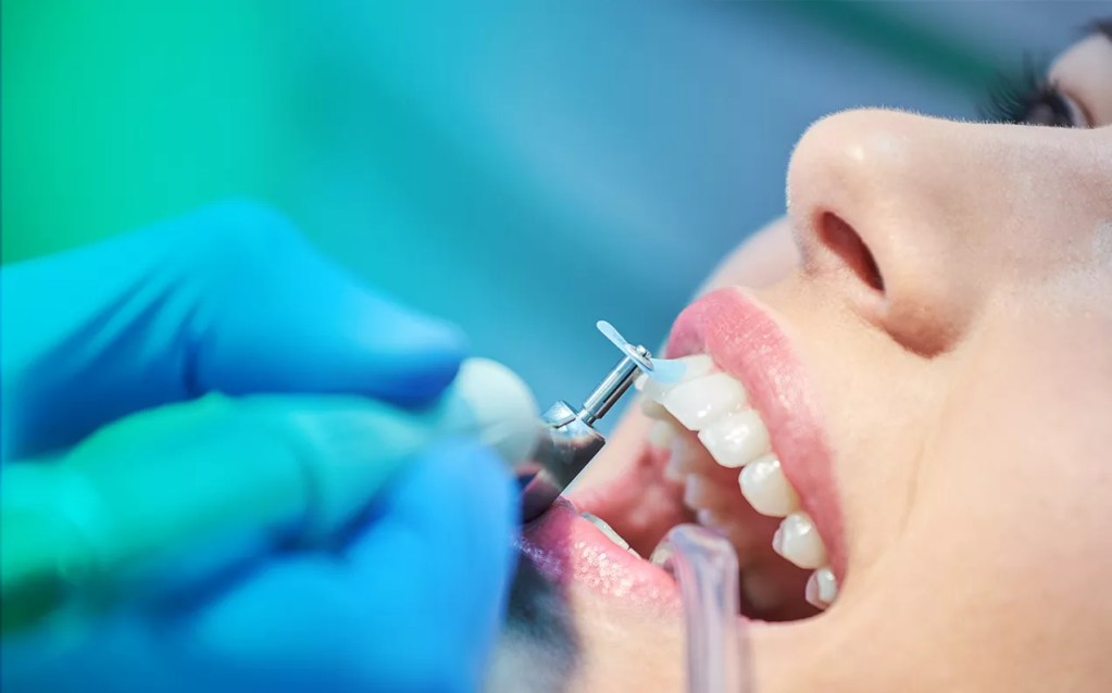 Dentista realizando limpeza dental em paciente