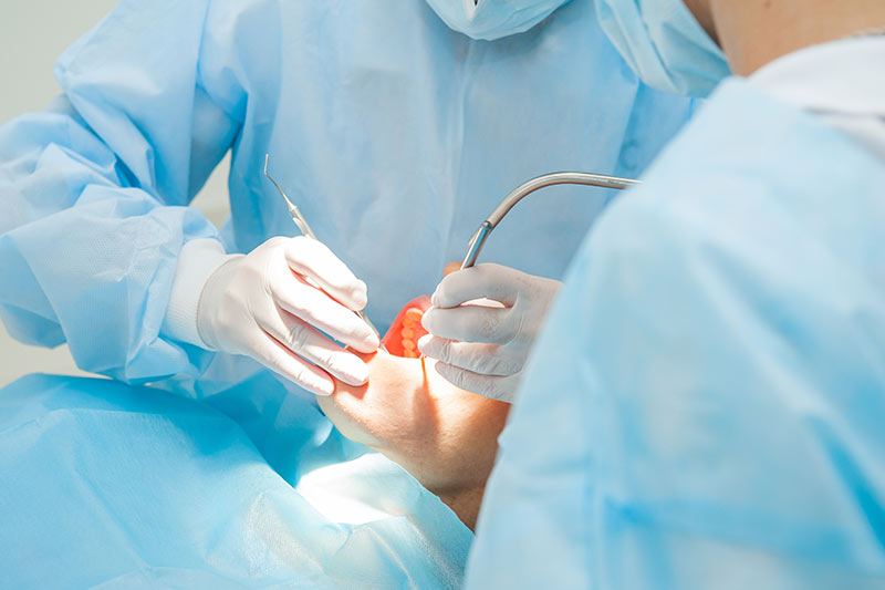 Dentistas com EPIS azuis realizando procedimento cirúrgico em paciente