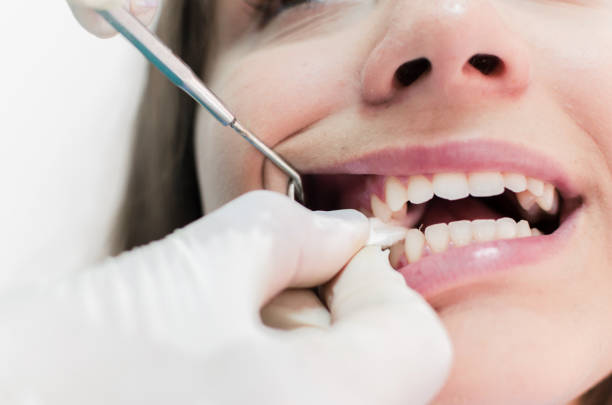 dentista colocando gaze em dente de cliente