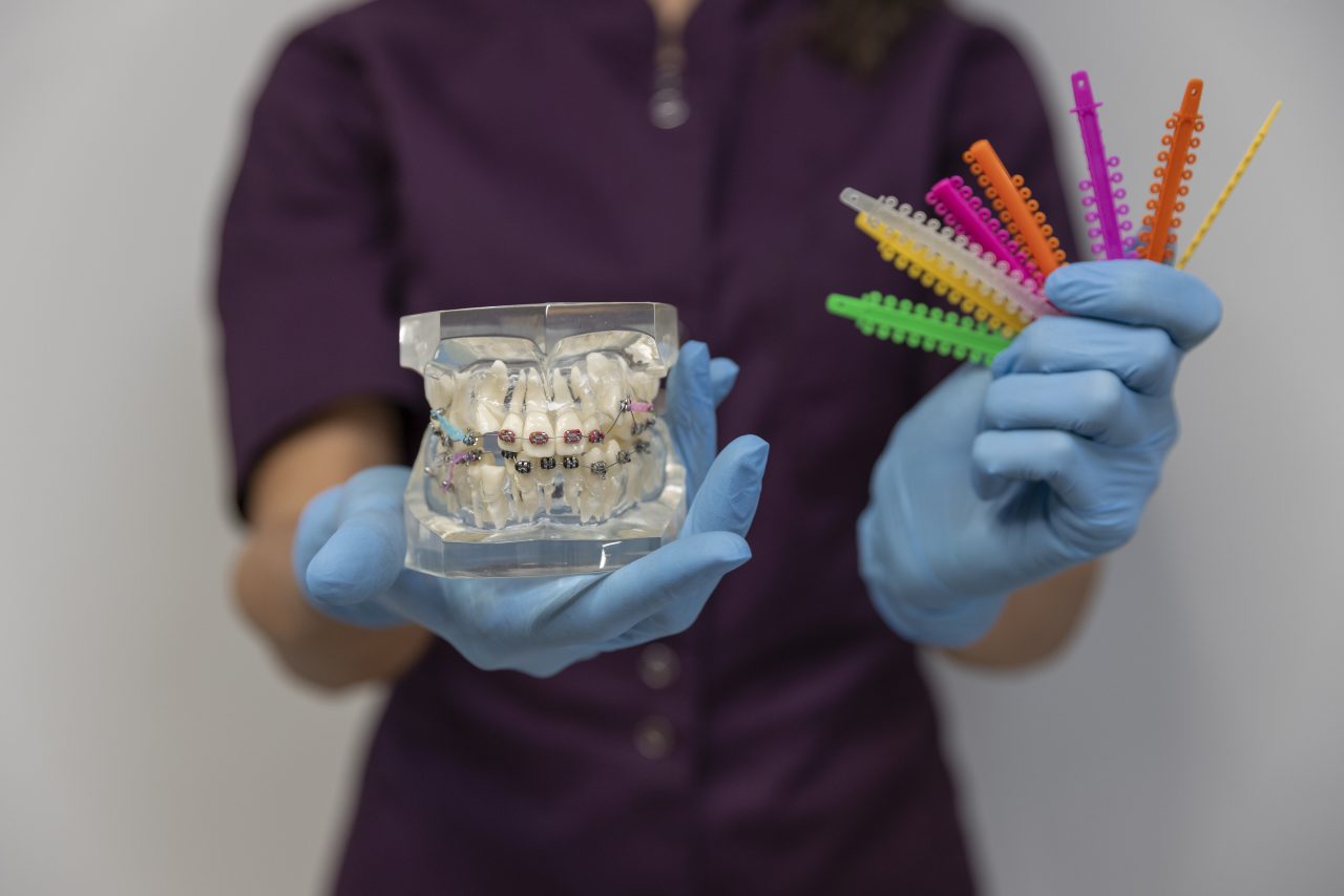 dentista segurando manequim de aparelho ortodôntico e braquetes coloridos