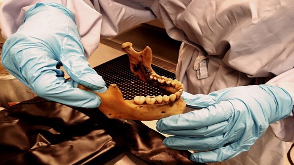 dentista forense segurando arcada dentária de crânio com luva