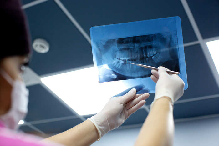 Dentista segurando panorâmica de boca de paciente contra luz