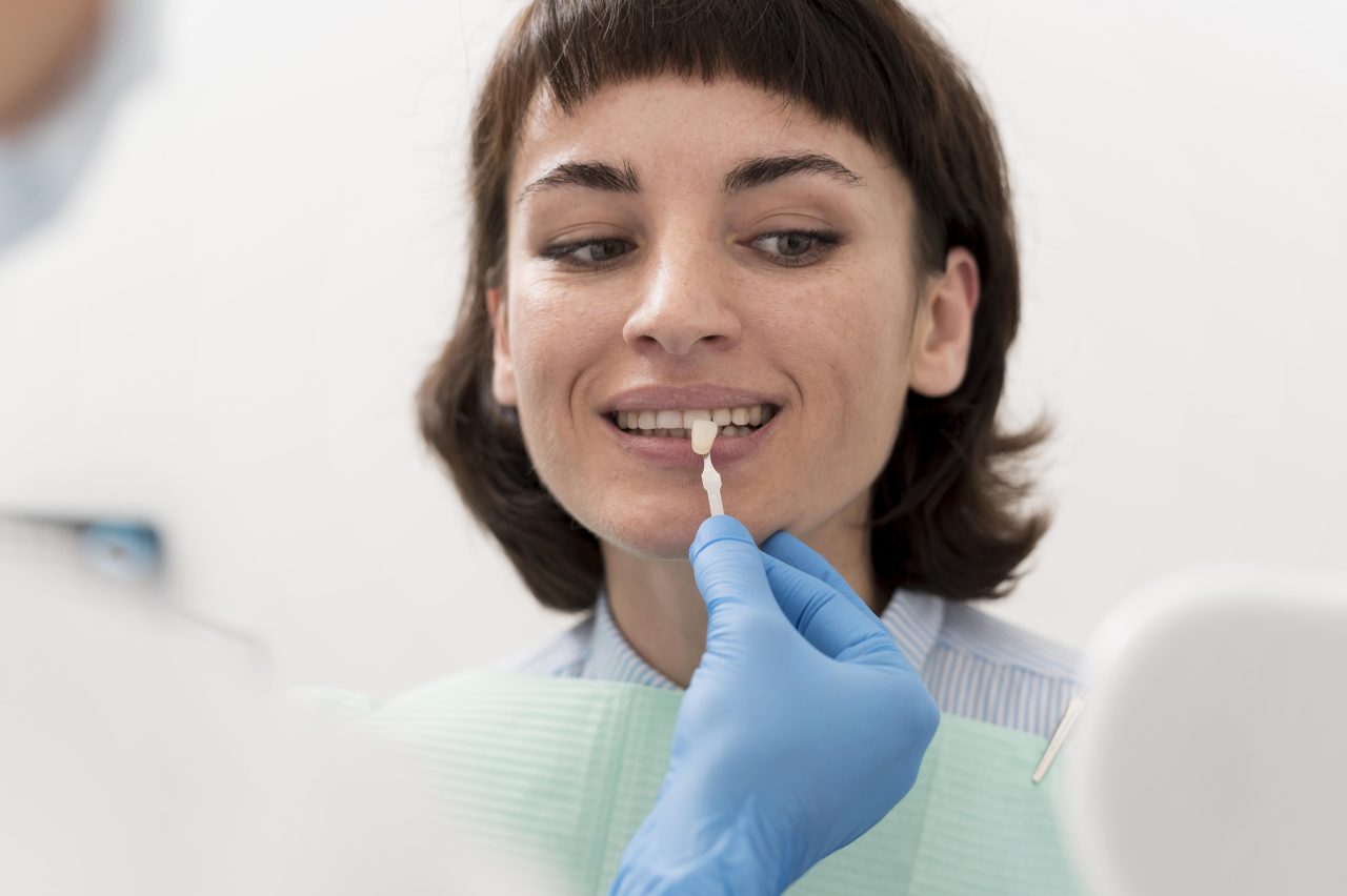 Dentista testando se a cor da faceta dentária combina com o dente da paciente, ao colocar a faceta ao lado de seu dente da frente. A paciente tem cabelo curto castanho com franja e olhos claros