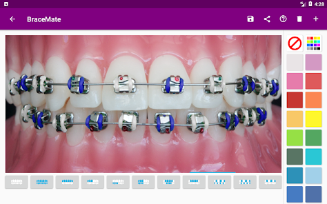 tela do aplicativo bracemate, com um aparelho ortodôntico e com uma paleta de cores no lado para escolher a cor da borrachinha