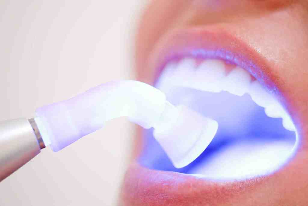 imagem mostra dentista realizando clareamento dental em paciente com luz azul
