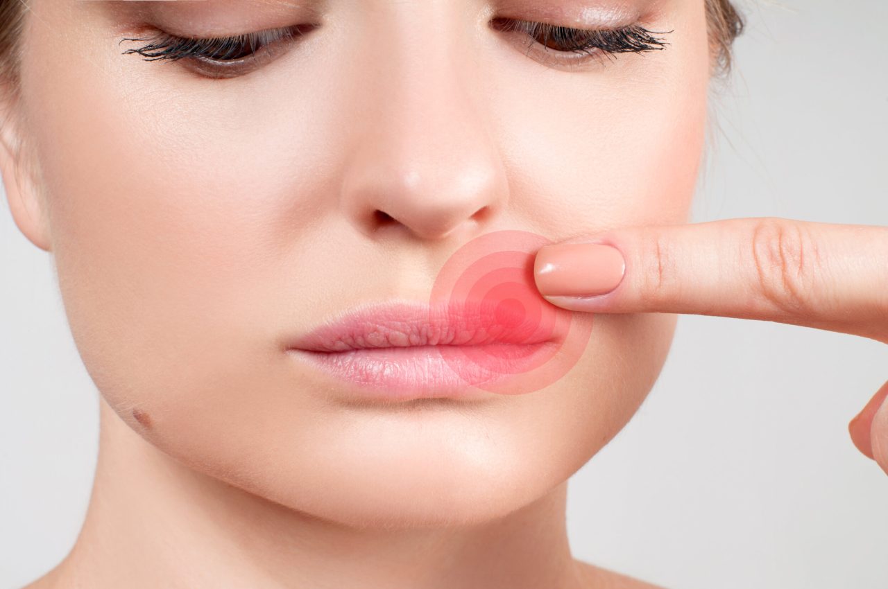 Mulher com expressão triste aponta para parte superior do lábio. Na imagem adicionaram uma luz vermelha onde ela encosta, indicando uma inflamação nessa parte.