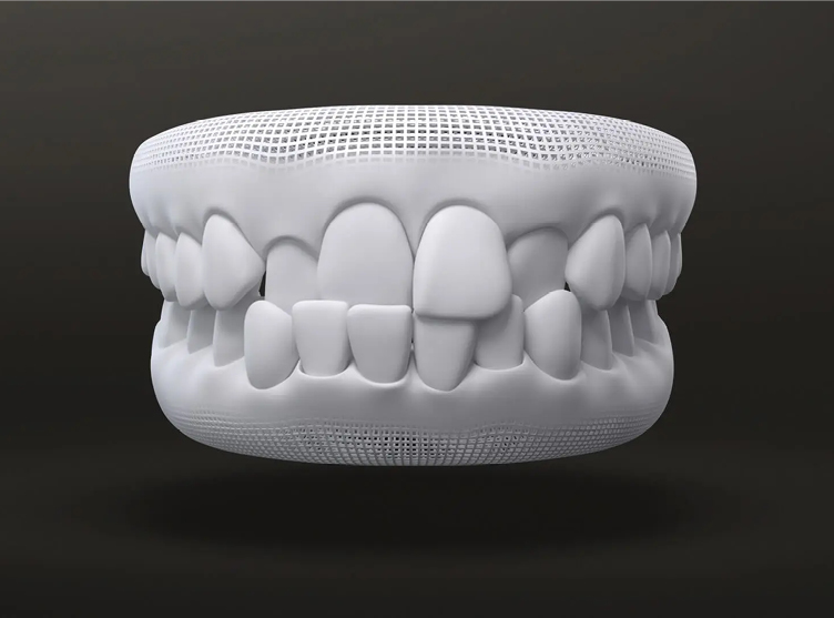 Protótipo 3d mostrando boca com mordida cruzada