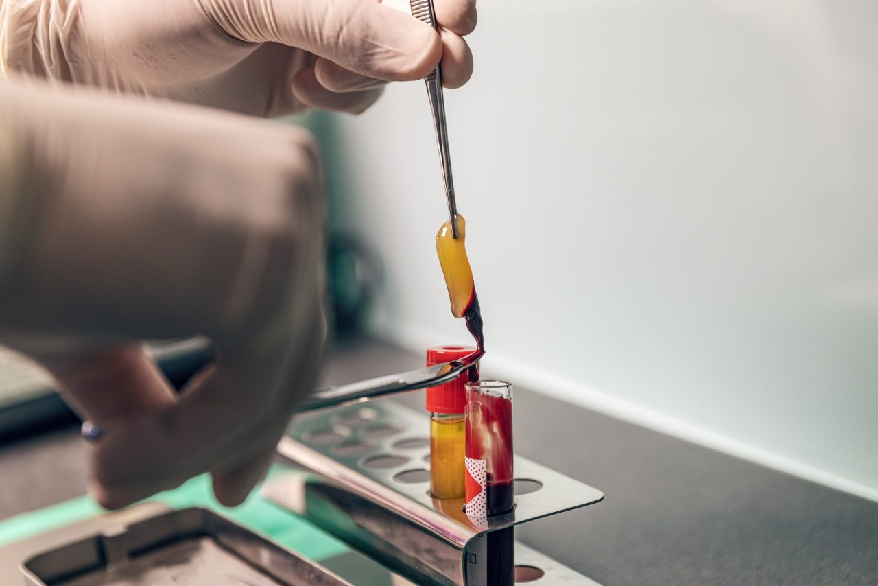 em laboratório mexendo com biomateriais na odontologia