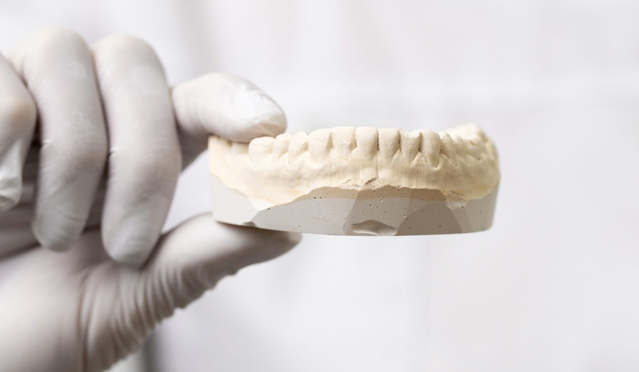 Pessoa usando luva branca e segurando molde de gesso de dentes