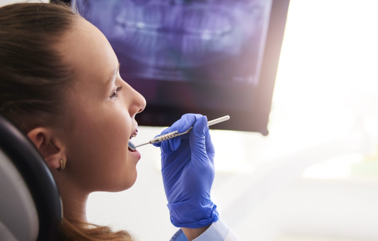 Criança sendo atendida em consultório odontológico. Em cima tem uma panorâmica da sua arcada dentária.