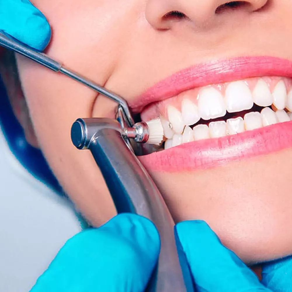 Dentista realizando limpeza de dente em paciente mulher que está sorrindo