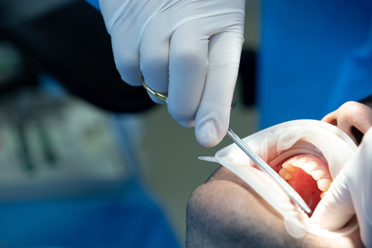 Dentista fazendo cirurgia em paciente