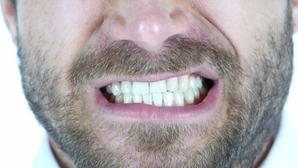 Homem de barba está rangendo os dentes