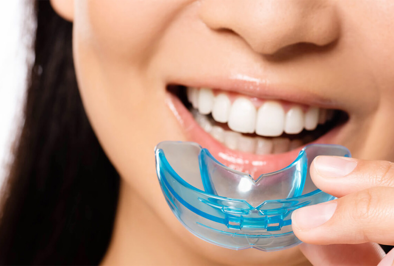 Mulher sorrindo e segurando suas placas de bruxismo azul