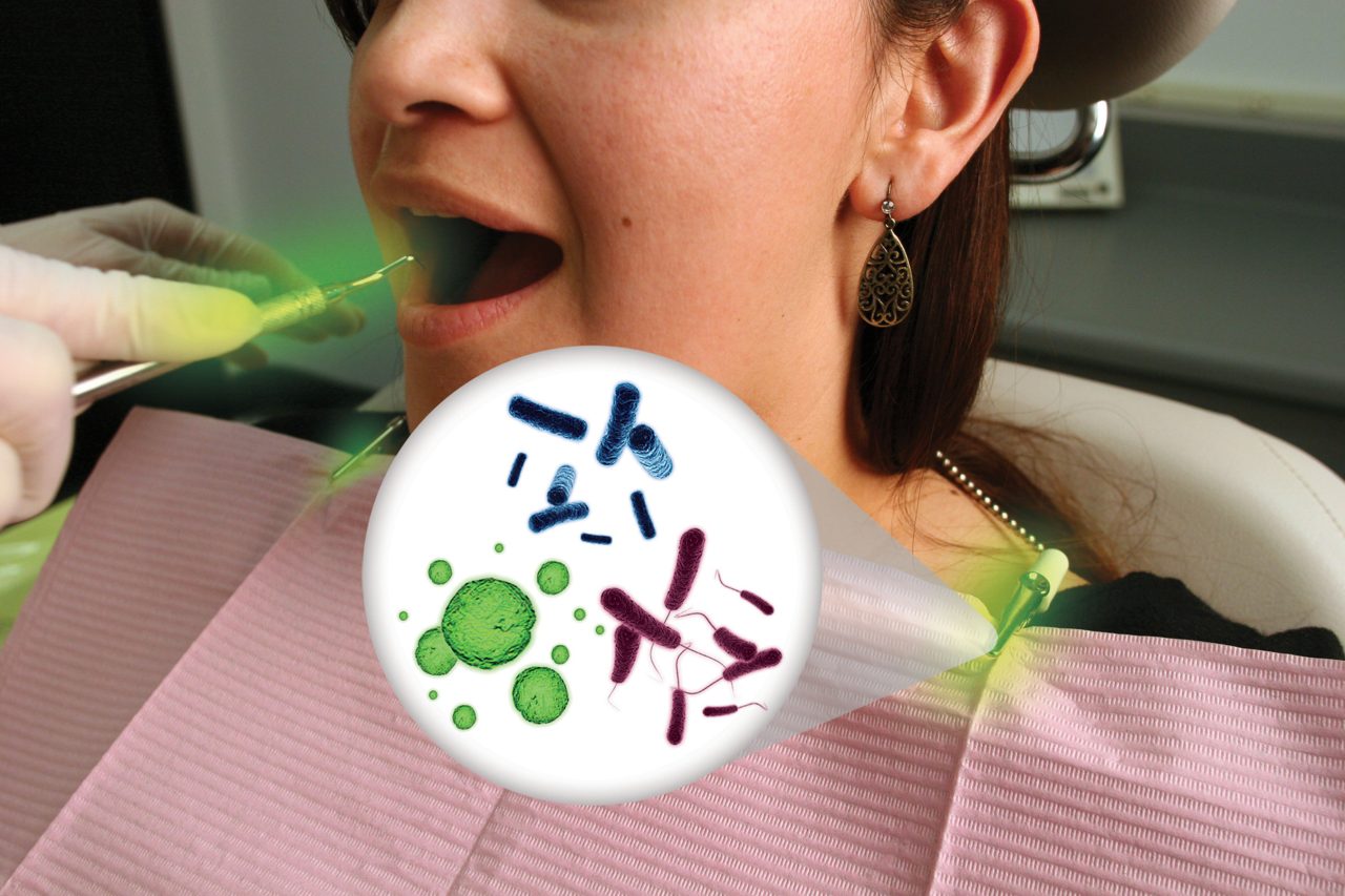 Mulher está sendo atendida no dentista. Enquanto isso, na imagem aparece manchas verdes indicando áreas que poderiam haver contaminação cruzada, e um desenho de microorganismos.