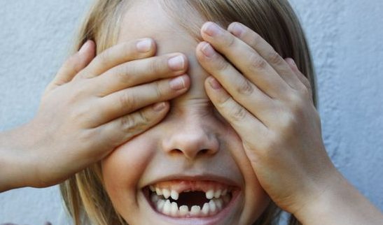 Criança está sorrindo, ela não tem mais os dentes da frente e está tampando os olhos com as mãos.