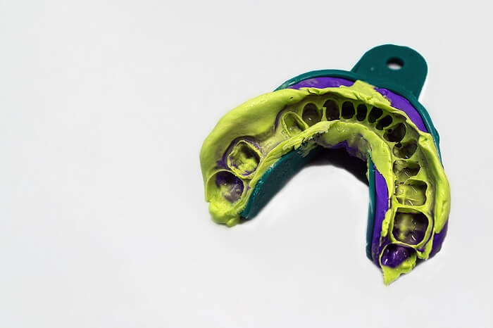 Moldagem em moldeira odontológica