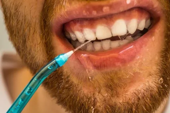 usando jato de água nos dentes