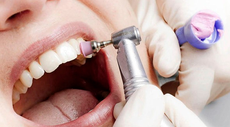 dentista realizando profilaxia em dentes de paciente