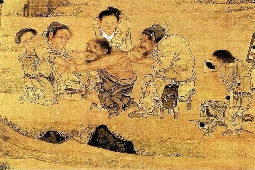 Pintura antiga da China de tratamento para dente com acupuntura.