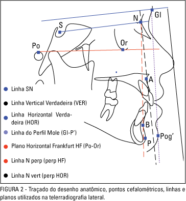 Desenho mostra vários tipos de planos e pontos ao medir o rosto.