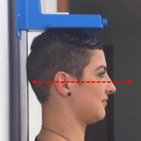 Mostra paciente parada embaixo de máquina e um tracejado em seu rosto mostrando que está posicionada certa segundo o plano de frankfurt.