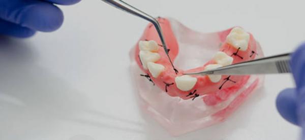 Treinando a remoção de suturas em manequim