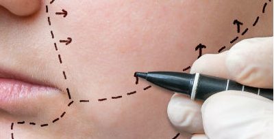 imagem de um dentista de luvas desenhando no rosto da paciente