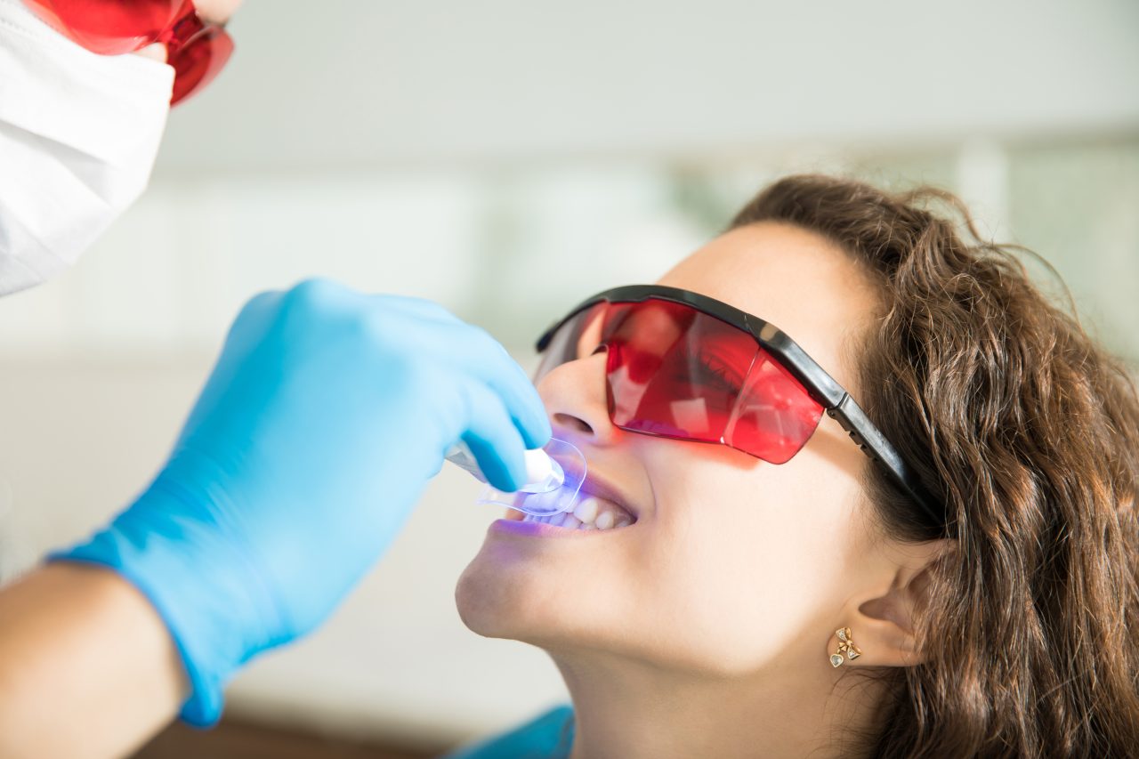 Realizando clareamento dental em paciente, pois impacta o sorriso na autoestima. Ela está usando um óculos de proteção ao.