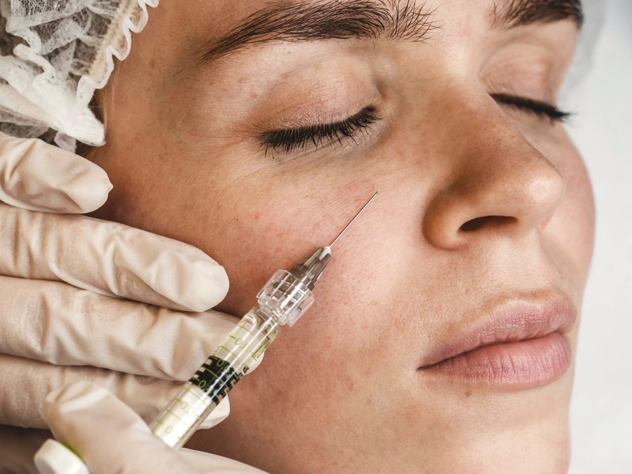 Profissional indo aplicar preenchedores faciais com seringa em bochecha de paciente.